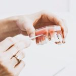 What are the aftercare instructions for dental implants?