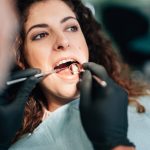 What are the benefits of teeth scaling?