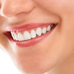 What to do before and after teeth whitening?