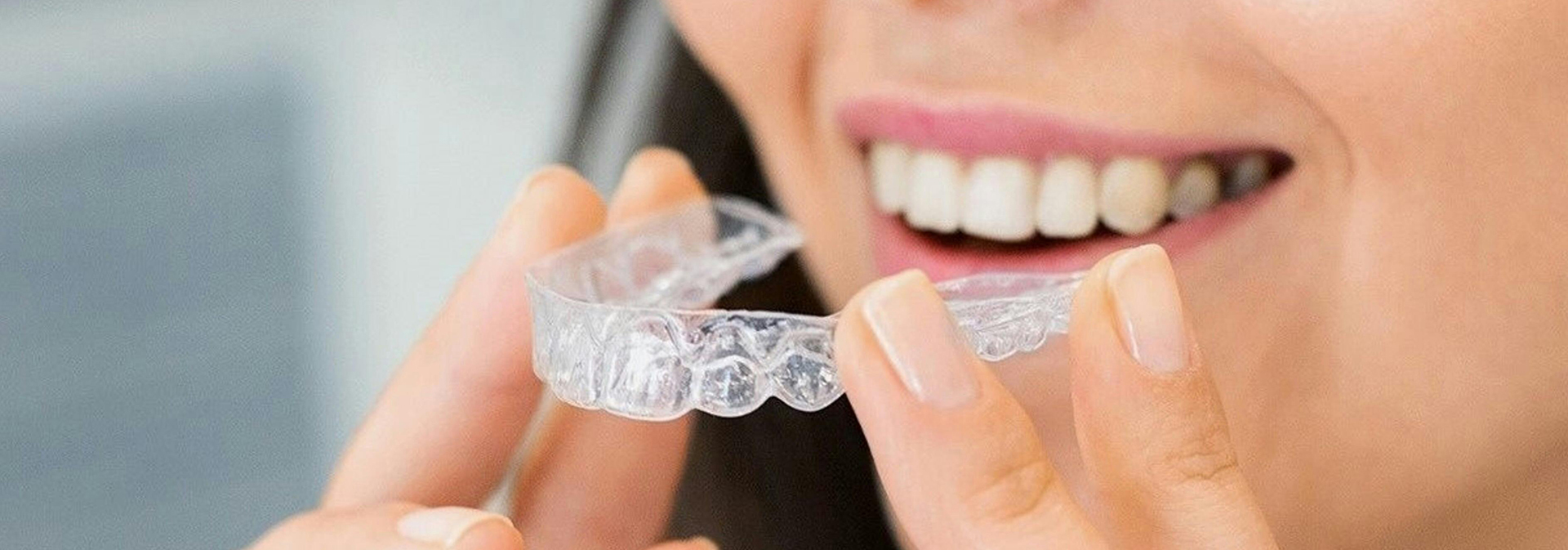 Clear Aligners