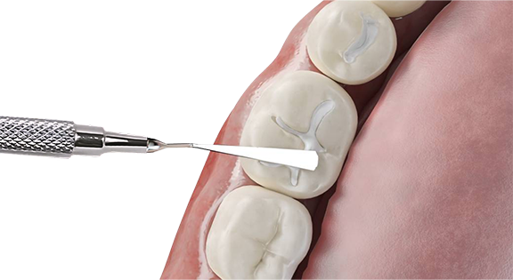 Royal Crown Family Dental