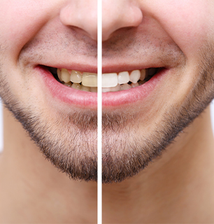 Royal Crown Family Dental